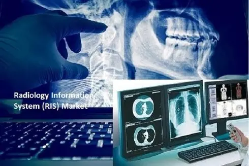 Kết nối LIS – RIS – PACS – EMR