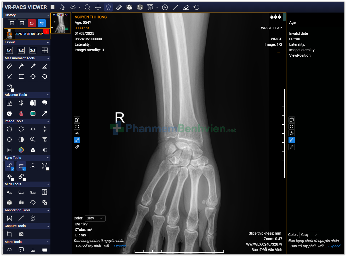 Hệ thống phần mềm bệnh viện tích hợp PACS