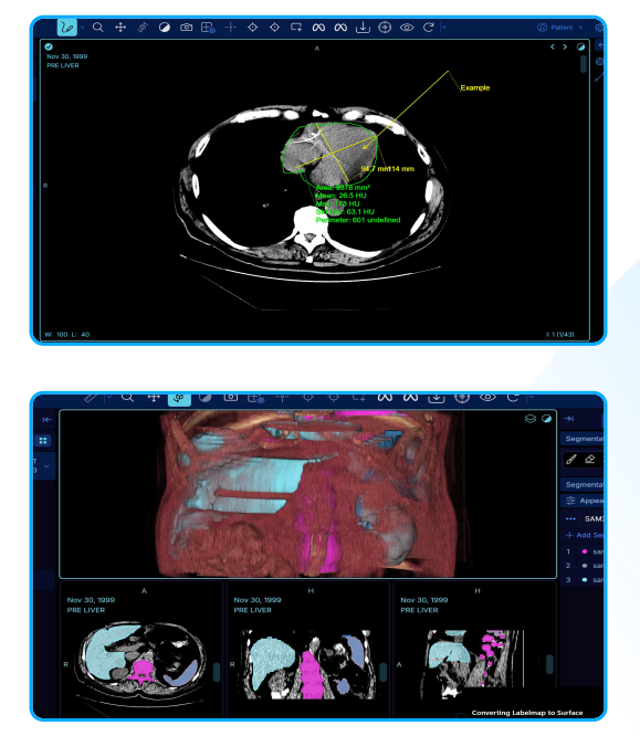 Công cụ đọc ảnh chuyên sâu cho bác sĩ
