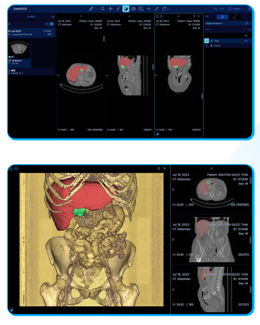 Hệ thống RIS – Quản lý quy trình chụp chiếu chuẩn hóa