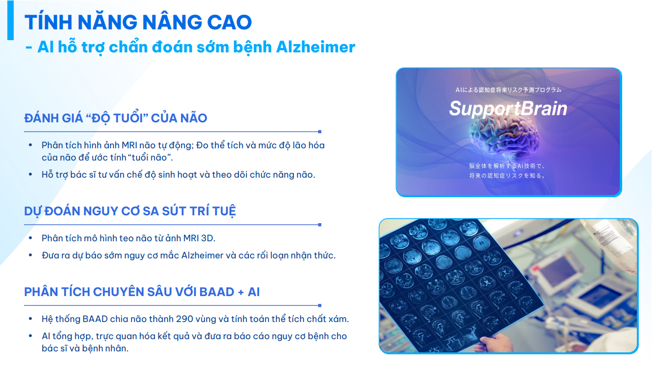 AI chẩn đoán sớm Alzheimer